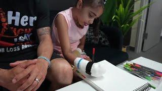 9-year-old Jackson girl learns how to be a kid again after limb loss