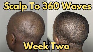 Scalp to 360 Waves - Week Two