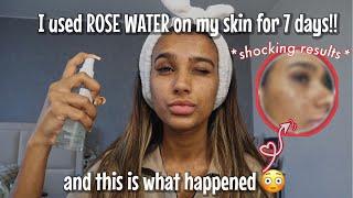 Unexpected reaction after I used ROSE WATER on my face for a week