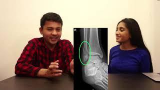 Distal Fibula Fracture