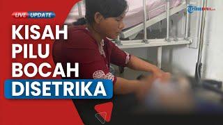 Bocah Yatim Disetrika Tante di Simalungun, Kesmida: Siap Asuh Korban dan Masukkan ke Dalam KK