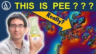 I put my urine under the microscope and saw crystals  244