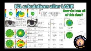 Methods for IOL calculations for Cataract Surgery after prior LASIK