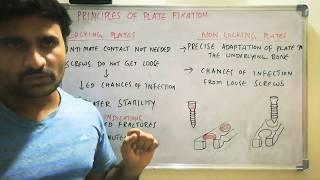 Locking vs Nonlocking plates