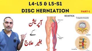 L4 - L5 and L5- S1 Disc Herniation Treatment | Slip Disc Treatment At Home #sciatica