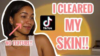 My VIRAL TikTok Skincare Routine! How To GET RID OF TEXTURED SKIN!! | No More Tiny Bumps