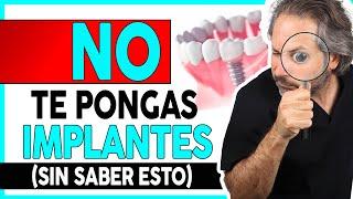 ¿Que 𝗗𝗘𝗕𝗢 𝗦𝗔𝗕𝗘𝗥 del proceso de colocación de 𝗜𝗠𝗣𝗟𝗔𝗡𝗧𝗘𝗦 𝗗𝗘𝗡𝗧𝗔𝗟𝗘𝗦 para elegir a el DENTISTA ADECUADO?