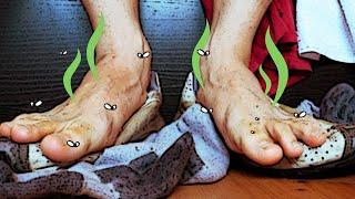 Do you suffer with sweaty smelly feet? | Benjamin Marble DPM