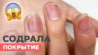 How to repair nails after ripping gel polish off | Damaged nails and nail extensions