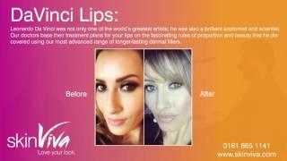 Da Vinci Lip Treatment | Q 'n' A | SkinViva Manchester