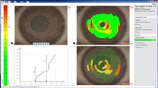 Antares - Tear Analysis 3/3