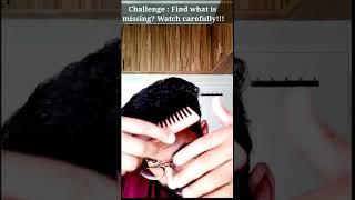 Best Hair Transplant Results Ever? | Ameer HT #ameerht