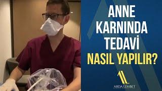 Anne Karnında Tedavi Nasıl Yapılır? (Operasyon Videosu) | Prof. Dr. Arda Lembet