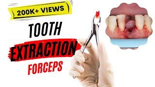 Dental extraction : Forceps