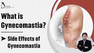 Gynecomastia Kya Hota hai? | Side Effects of Gynecomastia | What is Gyno? | What is Gynecomastia?