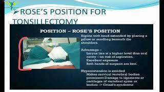 Tonsillectomy | ENT |Steps | Indications and contradictions | post operative care | Complications