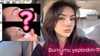 TÜRKÇE ASMR / BURUN AMELİYATI OLDUM  / FISILTI / AMELİYAT SÜRECİ VLOG🫧