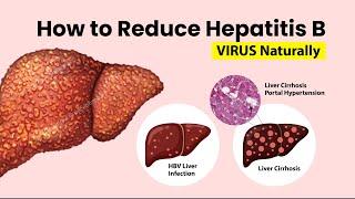 How to Reduce Hepatitis B Viral Load Naturally | How to Reduce Hepatitis B