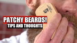 Patchy Beards! Tips & Thoughts