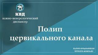 762  Полип цервикального канала