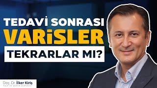 Varisler Tedavi Sonrası Tekrarlar mı? | Doç. Dr. İlker Kiriş