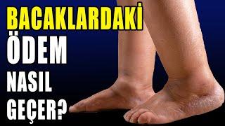 BACAKLARDAKİ ÖDEM NASIL GEÇER? #aktifizyo #ödem #bacakağrısı