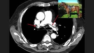 High Yield CT Scans (Part 1) || USMLE