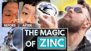 ZINC for SKIN HEALING (the Master Mineral!)