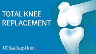 Total Knee Replacement Surgery | UC San Diego Health