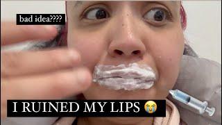 DAY IN MY LIFE | COME GET LIP FILLERS WITH ME