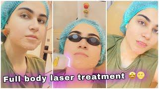 My FIRST EVER LASER TREATMENT **it hurts**