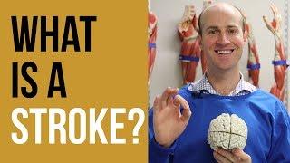 What is a STROKE?