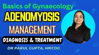 Management of Adenomyosis | Investigations & Treatment | Part-2