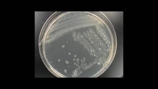 Identification of Unknown Bacteria