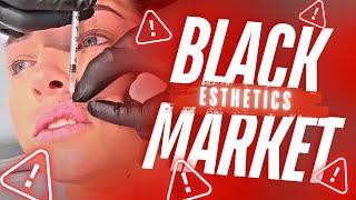 SCAMMERS  POSING AS DOCTORS | BLACK MARKET VENEERS & LIP FILLER TECHS