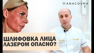 Лазерная шлифовка лица ОПАСНО? Восстановление, ДО и После