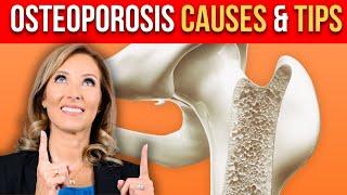 Osteoporosis Causes & Tips Your Dr. Didn’t Tell You | Dr. Janine