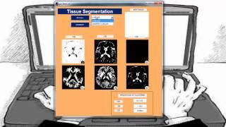 Matlab Thesis | Matlab Thesis Topics | Academic College Projects