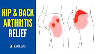 How to QUICKLY Relieve Hip and Back Arthritis Pain