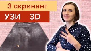 Скрининг третьего триместра 3 УЗИ скрининг и кадры 3D узи️