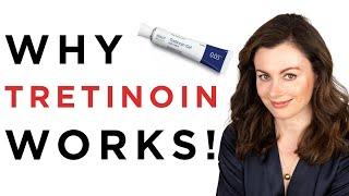 Is Tretinoin the BEST Treatment For Acne? | Dr Sam Bunting