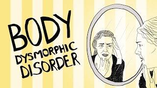 What is Body Dysmorphic Disorder