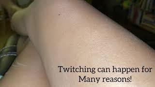 Twitches Caught On Camera! Thigh Hotspot