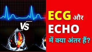 ECG vs ECHO Difference in Hindi | Heart Electrocardiograph vs Echo-cardiogram