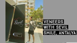 I GOT VENEERS WITH SEVIL SMILE STUDIO ANTALYA TURKEY . THE BEST DENTIST!!