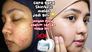 TAMBAH PARAH ?! REVIEW SKINTIFIC 5X CERAMIDE BARRIER REPAIR MOISTURE GEL RACUN DARI TASYA FARASYA !