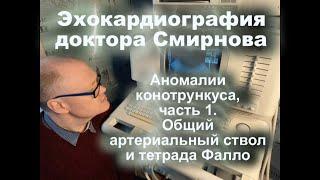 27. Аномалии конотрункуса, часть 1. Общий артериальный ствол и тетрада Фалло