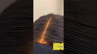 How to fix your over bleached frontal wig knots temporarily #shorts #wig #frontal #hair #fix #bleach