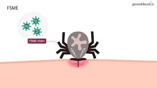 FSME: Welche Krankheiten übertragen Zecken?