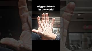 Biggest hand in the world vs Normal people's #armwrestling #trending #viral #shorts